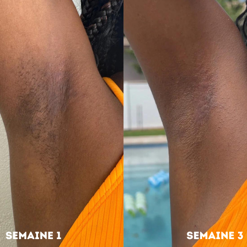 Pads Nettoyants à l'acide kojique et au curcuma